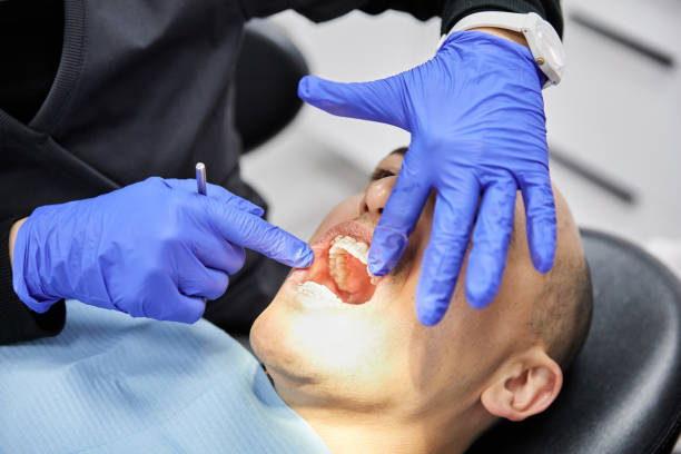 Best Emergency Root Canal Treatment in Ives Estates, FL