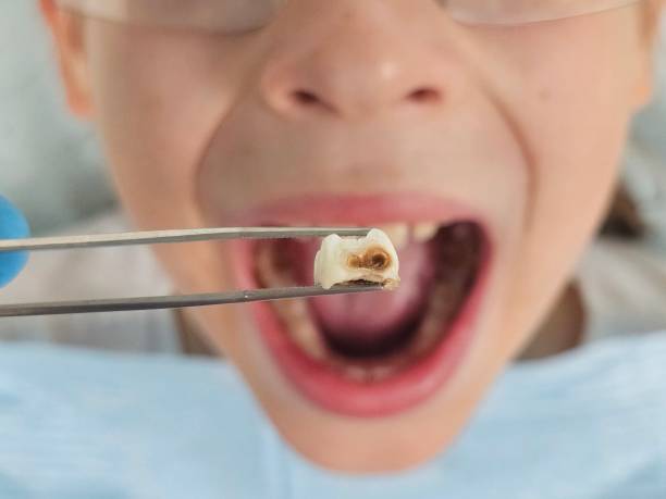 Best Emergency Dental Services for Seniors in Ives Estates, FL