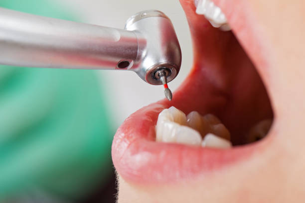 Best Weekend Emergency Dentist in Ives Estates, FL